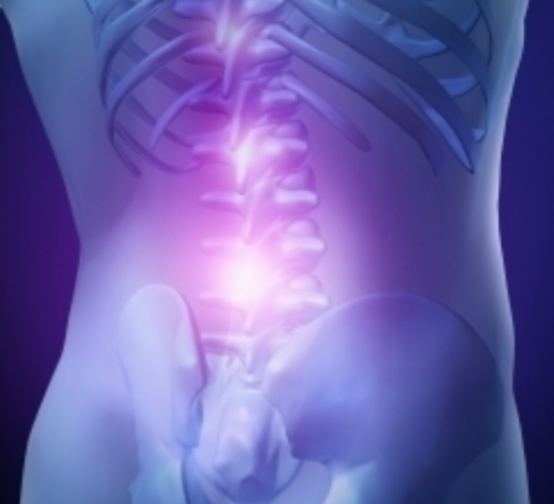 腰痛の約70%は筋筋膜性腰痛症が原因です