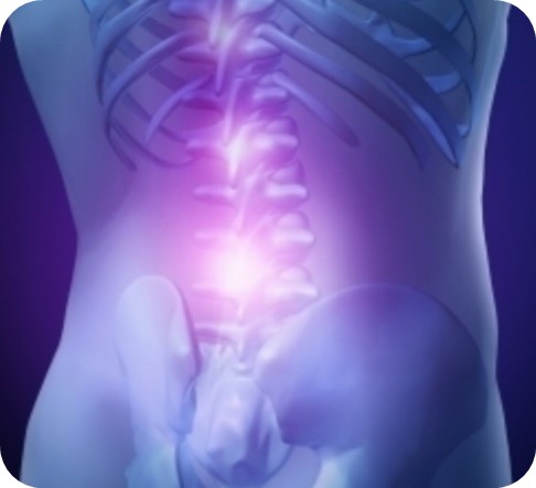 腰痛の約70%は筋筋膜性腰痛症が原因です